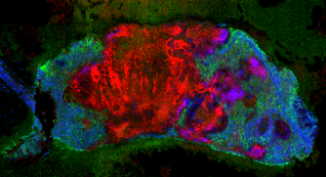 Ceramides in colorectal tissue