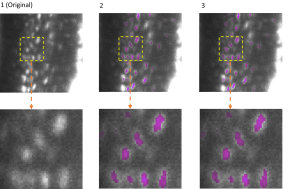 Die Abbildung zeigt die 3D-Semantiksegmentierung von Osteozyten in Mäuseknochen vor und nach der Kompression des Modells mir EfficientBioAI Die Bilder wurden mittels Lichtblatt-Fluoreszenzmikroskopie aufgenommen.