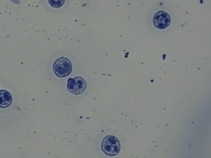 CD177 negative Neutrophile